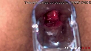 hey, check out this anal speculum on a huge bbw slut 😏 tight and hairy