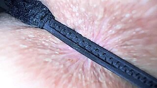 a girl frets her pigmented anal looks dirty even clean is that real worry